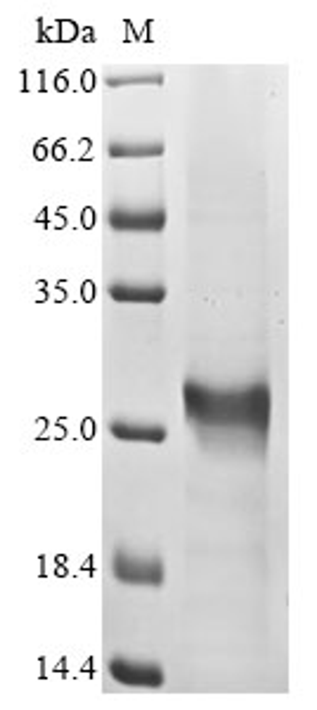 (Tris-Glycine gel) Discontinuous SDS-PAGE (reduced) with 5% enrichment gel and 15% separation gel.