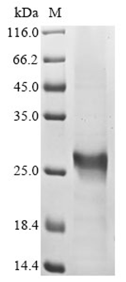 (Tris-Glycine gel) Discontinuous SDS-PAGE (reduced) with 5% enrichment gel and 15% separation gel.