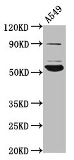 Western Blot. Positive WB detected in: A549 whole cell lysate. All lanes: PIGV antibody at 4.6µg/ml. Secondary. Goat polyclonal to rabbit IgG at 1/50000 dilution. Predicted band size: 56 kDa. Observed band size: 56 kDa