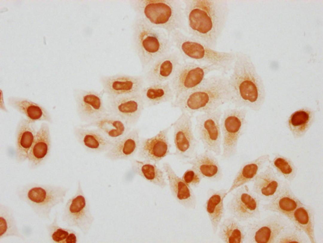 Immunocytochemistry analysis of CSB-PA010429PA31butHU diluted at 1:50 and staining in Hela cells(treated with 30mM sodium butyrate for 4h) performed on a Leica BondTM system. The cells were fixed in 4% formaldehyde, permeabilized using 0.2% Triton X-100 and blocked with 10% normal goat serum 30min at RT. Then primary antibody (1% BSA) was incubated at 4°C overnight. The primary is detected by a biotinylated secondary antibody and visualized using an HRP conjugated SP system.