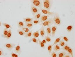 Immunocytochemistry analysis of CSB-PA010429PA31butHU diluted at 1:50 and staining in Hela cells(treated with 30mM sodium butyrate for 4h) performed on a Leica BondTM system. The cells were fixed in 4% formaldehyde, permeabilized using 0.2% Triton X-100 and blocked with 10% normal goat serum 30min at RT. Then primary antibody (1% BSA) was incubated at 4°C overnight. The primary is detected by a biotinylated secondary antibody and visualized using an HRP conjugated SP system.