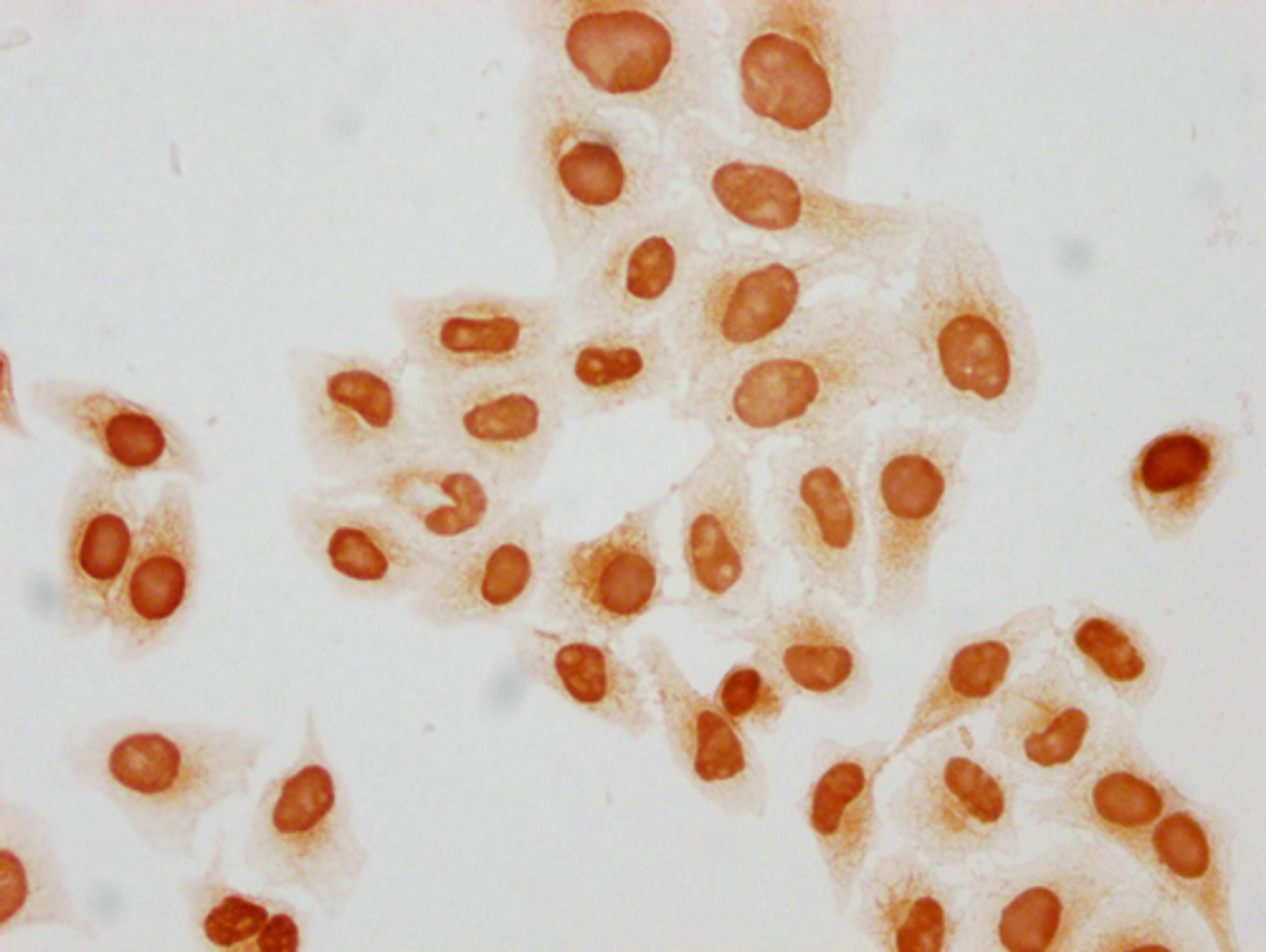 Immunocytochemistry analysis of CSB-PA010429PA31butHU diluted at 1:50 and staining in Hela cells(treated with 30mM sodium butyrate for 4h) performed on a Leica BondTM system. The cells were fixed in 4% formaldehyde, permeabilized using 0.2% Triton X-100 and blocked with 10% normal goat serum 30min at RT. Then primary antibody (1% BSA) was incubated at 4°C overnight. The primary is detected by a biotinylated secondary antibody and visualized using an HRP conjugated SP system.