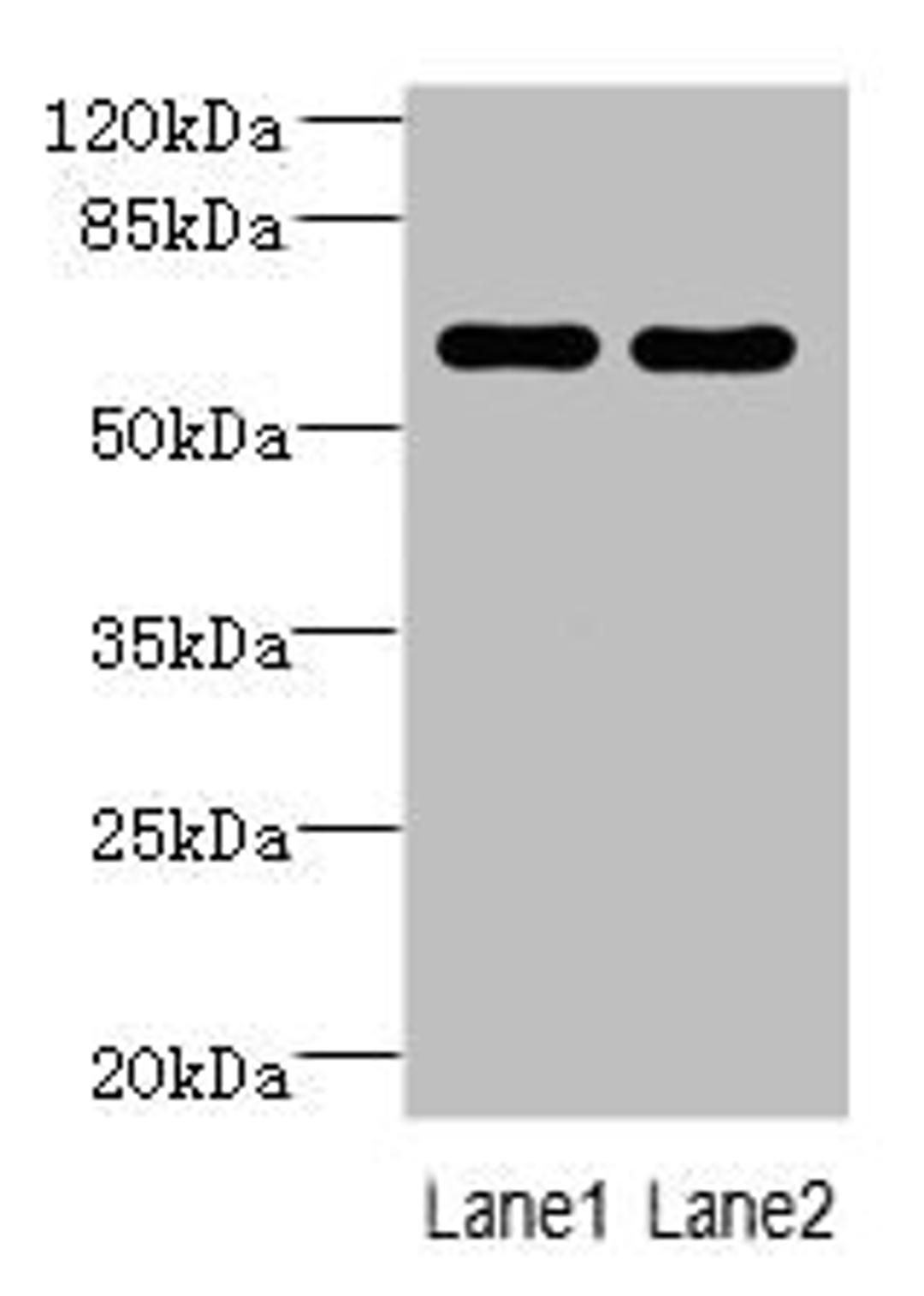 Western blot. All lanes: ZNF215 antibody at 3µg/ml. Lane 1: Hela whole cell lysate. Lane 2: A431 whole cell lysate. Secondary. Goat polyclonal to rabbit IgG at 1/10000 dilution. Predicted band size: 61, 36 kDa. Observed band size: 61 kDa