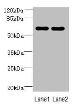 Western blot. All lanes: ZNF215 antibody at 3µg/ml. Lane 1: Hela whole cell lysate. Lane 2: A431 whole cell lysate. Secondary. Goat polyclonal to rabbit IgG at 1/10000 dilution. Predicted band size: 61, 36 kDa. Observed band size: 61 kDa