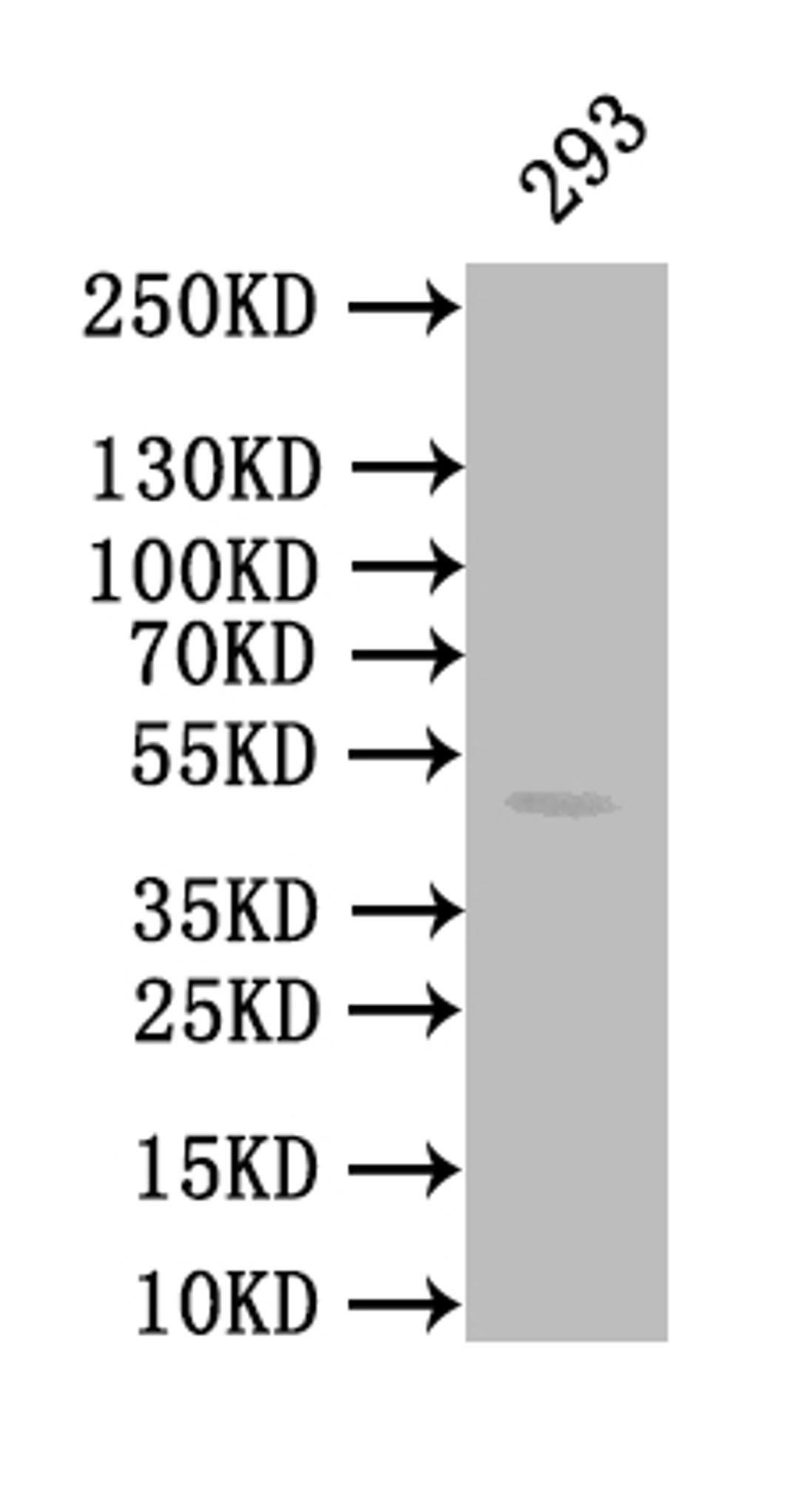 Western Blot. Positive WB detected in: 293 whole cell lysate. All lanes: CALR antibody at 1:1000. Secondary. Goat polyclonal to mouse IgG at 1/50000 dilution. Predicted band size: 49 kDa. Observed band size: 49 kDa. 
