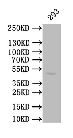 Western Blot. Positive WB detected in: 293 whole cell lysate. All lanes: CALR antibody at 1:1000. Secondary. Goat polyclonal to mouse IgG at 1/50000 dilution. Predicted band size: 49 kDa. Observed band size: 49 kDa. 