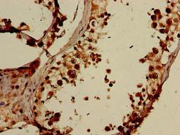 Immunohistochemistry of paraffin-embedded human testis tissue using CSB-PA880925LA01HU at dilution of 1:100