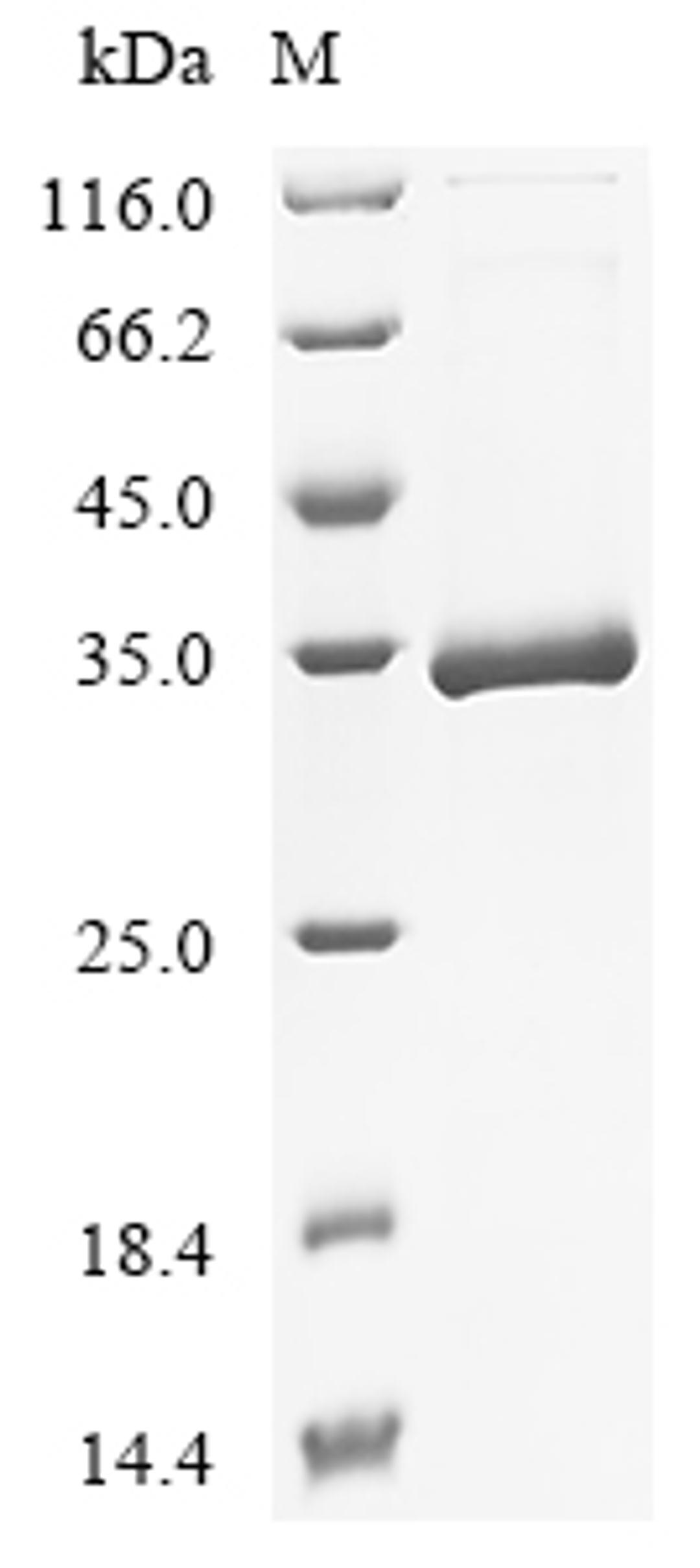 (Tris-Glycine gel) Discontinuous SDS-PAGE (reduced) with 5% enrichment gel and 15% separation gel.