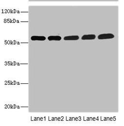 Western blot. All lanes: MPP6 antibody at 3.58ug/ml. Lane 1: Mouse brain tissue. Lane 2: Mouse kidney tissue. Lane 3: HepG2 whole cell lysate. Lane 4: Hela whole cell lysate. Lane 5: A549 whole cell lysate. Secondary. Goat polyclonal to rabbit IgG at 1/10000 dilution. Predicted band size: 61 kDa. Observed band size: 61 kDa. 