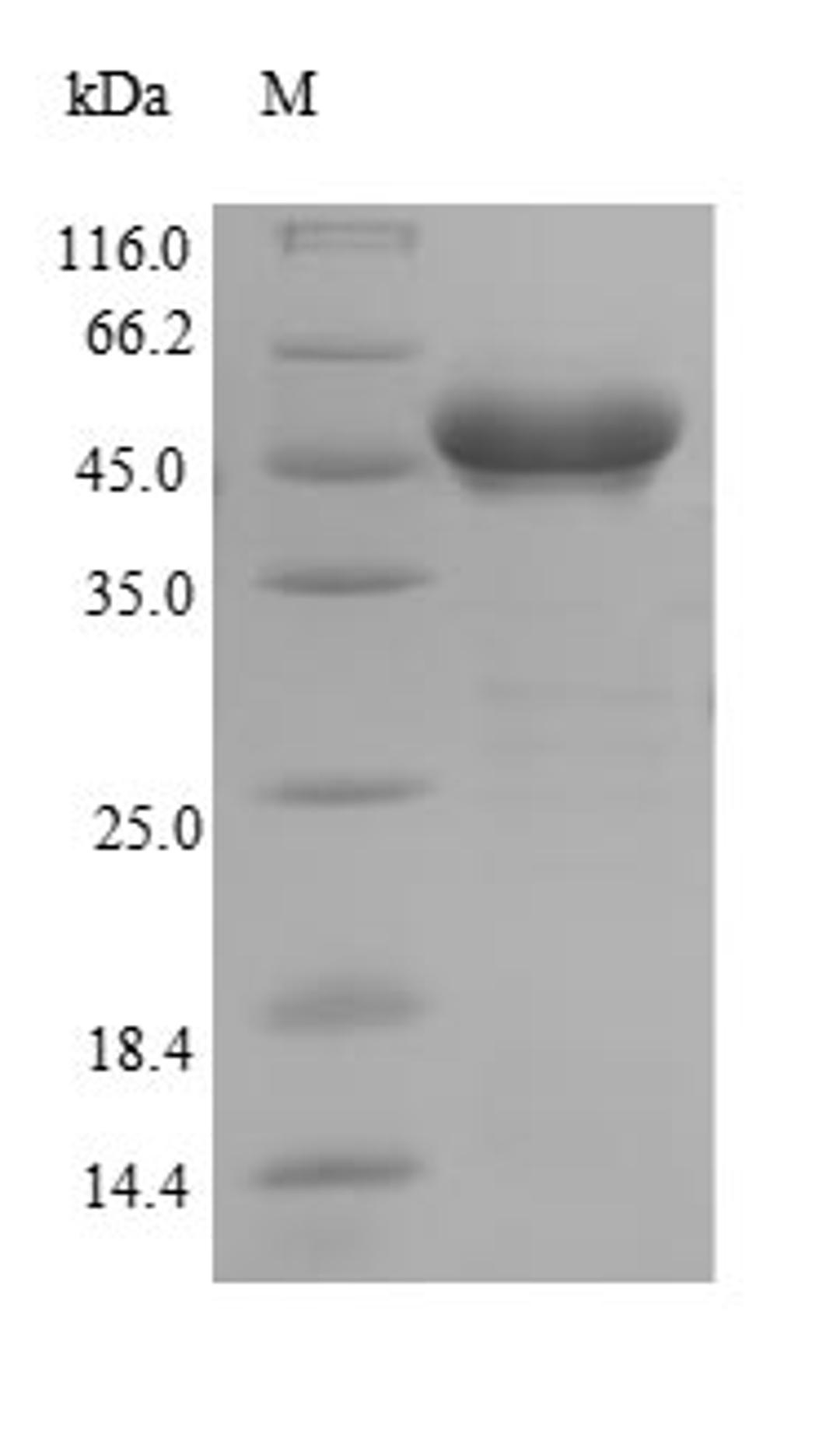 (Tris-Glycine gel) Discontinuous SDS-PAGE (reduced) with 5% enrichment gel and 15% separation gel.