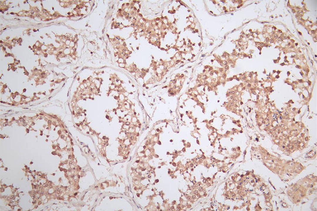 IHC image of CSB-RA620753A0HU diluted at 1:50 and staining in paraffin-embedded human testis tissue performed on a Leica BondTM system. After dewaxing and hydration, antigen retrieval was mediated by high pressure in a citrate buffer (pH 6.0). Section was blocked with 10% normal goat serum 30min at RT. Then primary antibody (1% BSA) was incubated at 4°C overnight. The primary is detected by a Goat anti-rabbit polymer IgG labeled by HRP and visualized using 0.79% DAB.