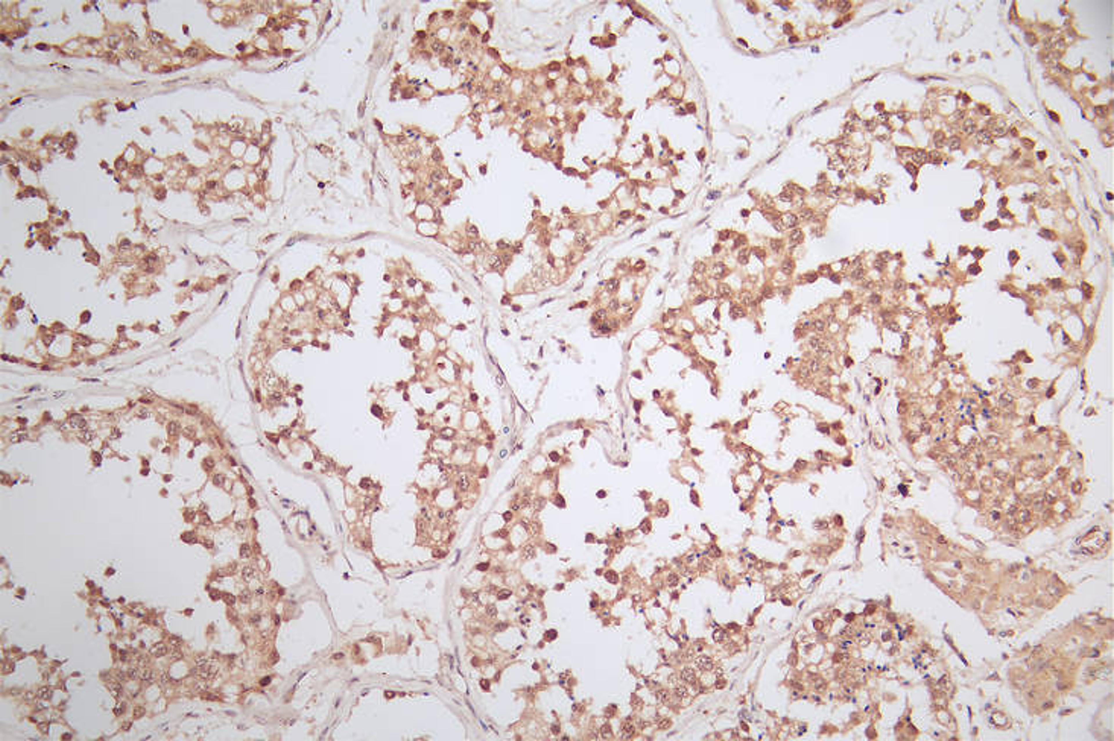 IHC image of CSB-RA620753A0HU diluted at 1:50 and staining in paraffin-embedded human testis tissue performed on a Leica BondTM system. After dewaxing and hydration, antigen retrieval was mediated by high pressure in a citrate buffer (pH 6.0). Section was blocked with 10% normal goat serum 30min at RT. Then primary antibody (1% BSA) was incubated at 4°C overnight. The primary is detected by a Goat anti-rabbit polymer IgG labeled by HRP and visualized using 0.79% DAB.