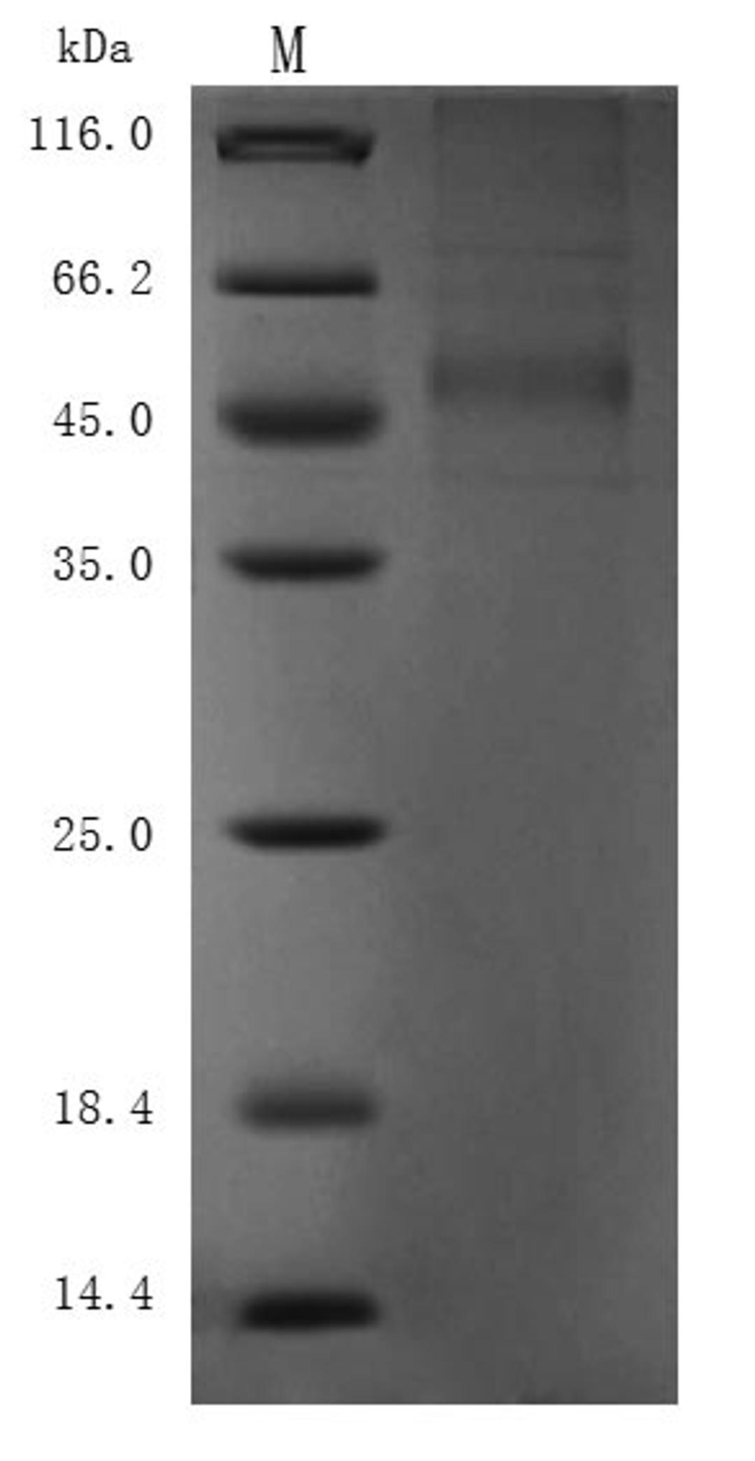 (Tris-Glycine gel) Discontinuous SDS-PAGE (reduced) with 5% enrichment gel and 15% separation gel.