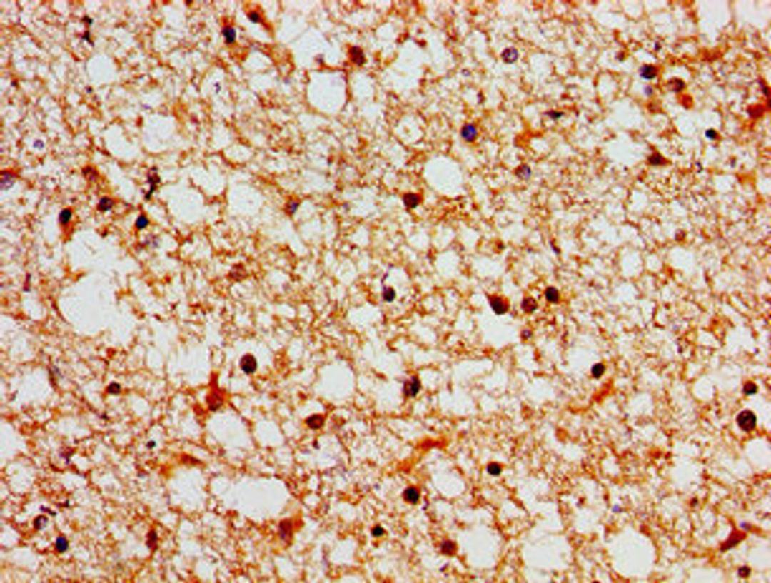 Immunohistochemistry of paraffin-embedded human brain tissue using CSB-PA819482LA01HU at dilution of 1:100