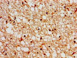 Immunohistochemistry of paraffin-embedded human brain tissue using CSB-PA819482LA01HU at dilution of 1:100