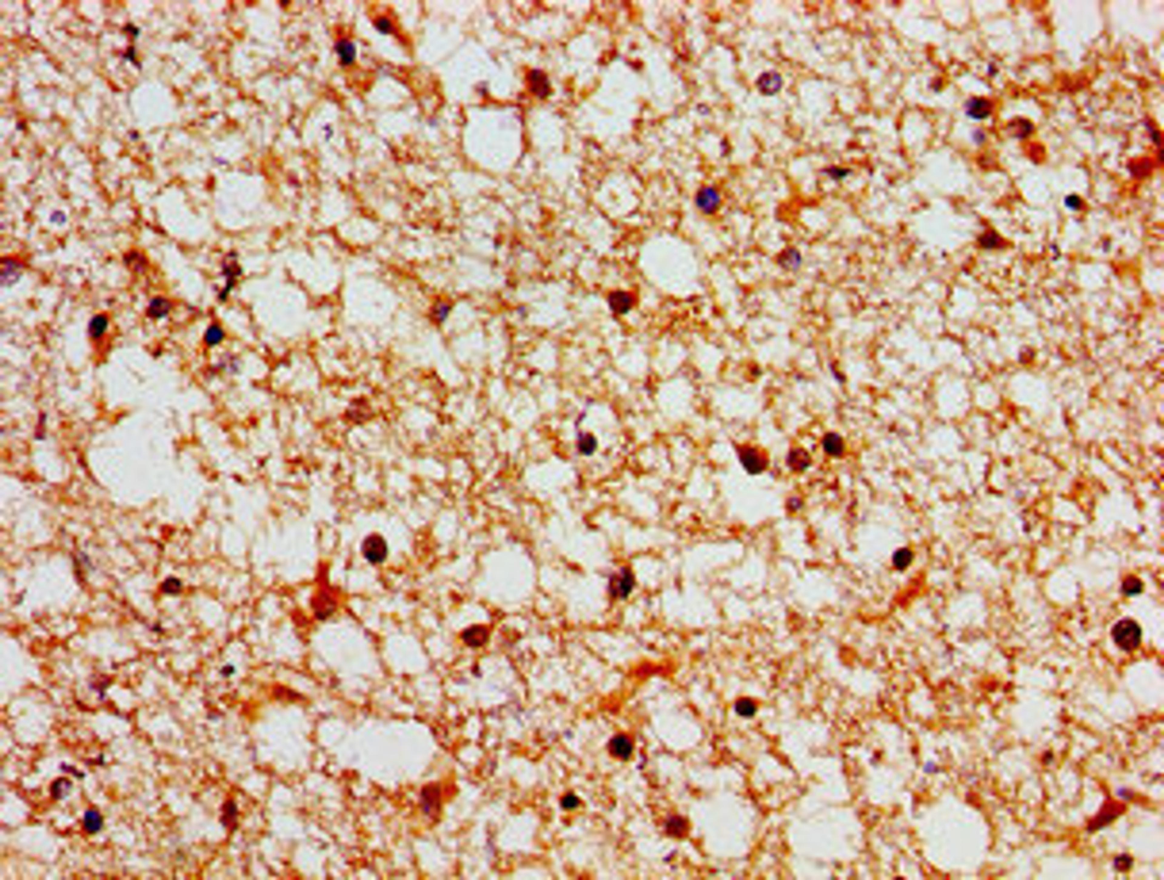 Immunohistochemistry of paraffin-embedded human brain tissue using CSB-PA819482LA01HU at dilution of 1:100