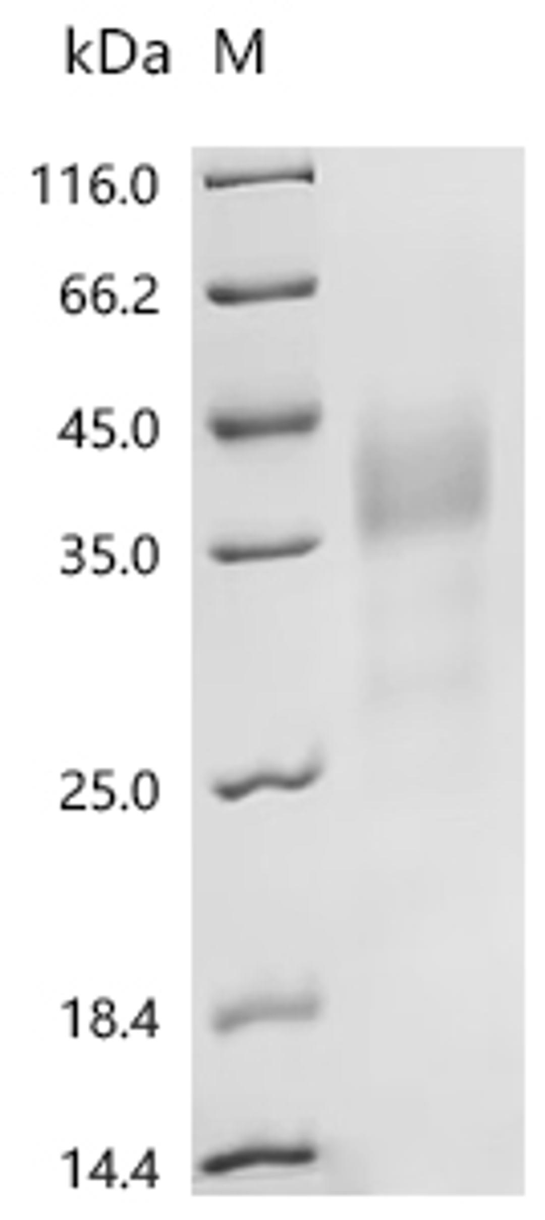 (Tris-Glycine gel) Discontinuous SDS-PAGE (reduced) with 5% enrichment gel and 15% separation gel.