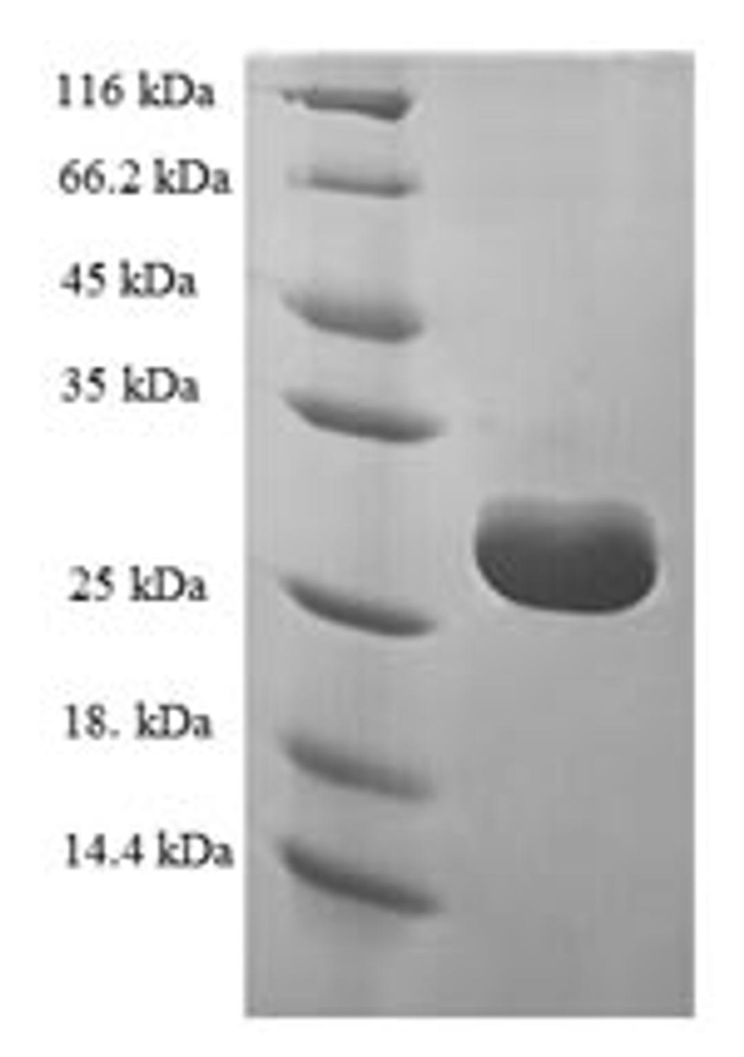 (Tris-Glycine gel) Discontinuous SDS-PAGE (reduced) with 5% enrichment gel and 15% separation gel.