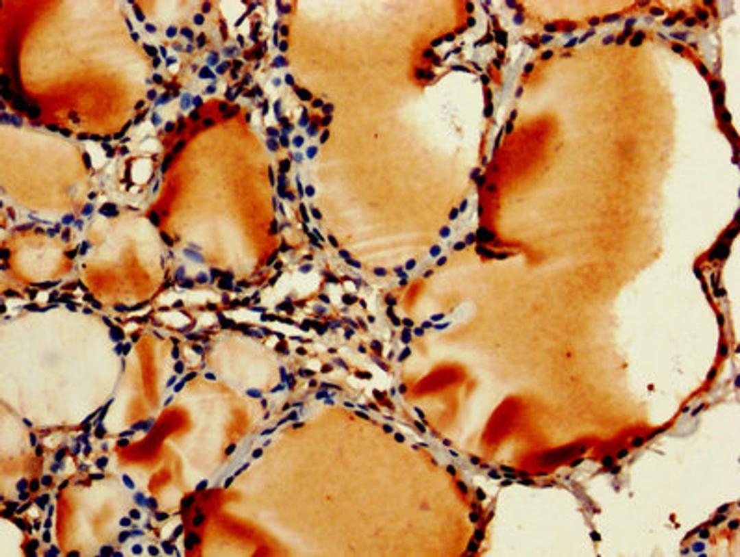 IHC image of CSB-PA00065A0Rb diluted at 1:250 and staining in paraffin-embedded human thyroid tissue performed on a Leica BondTM system. After dewaxing and hydration, antigen retrieval was mediated by high pressure in a citrate buffer (pH 6.0). Section was blocked with 10% normal goat serum 30min at RT. Then primary antibody (1% BSA) was incubated at 4&deg;C overnight. The primary is detected by a biotinylated secondary antibody and visualized using an HRP conjugated SP system.