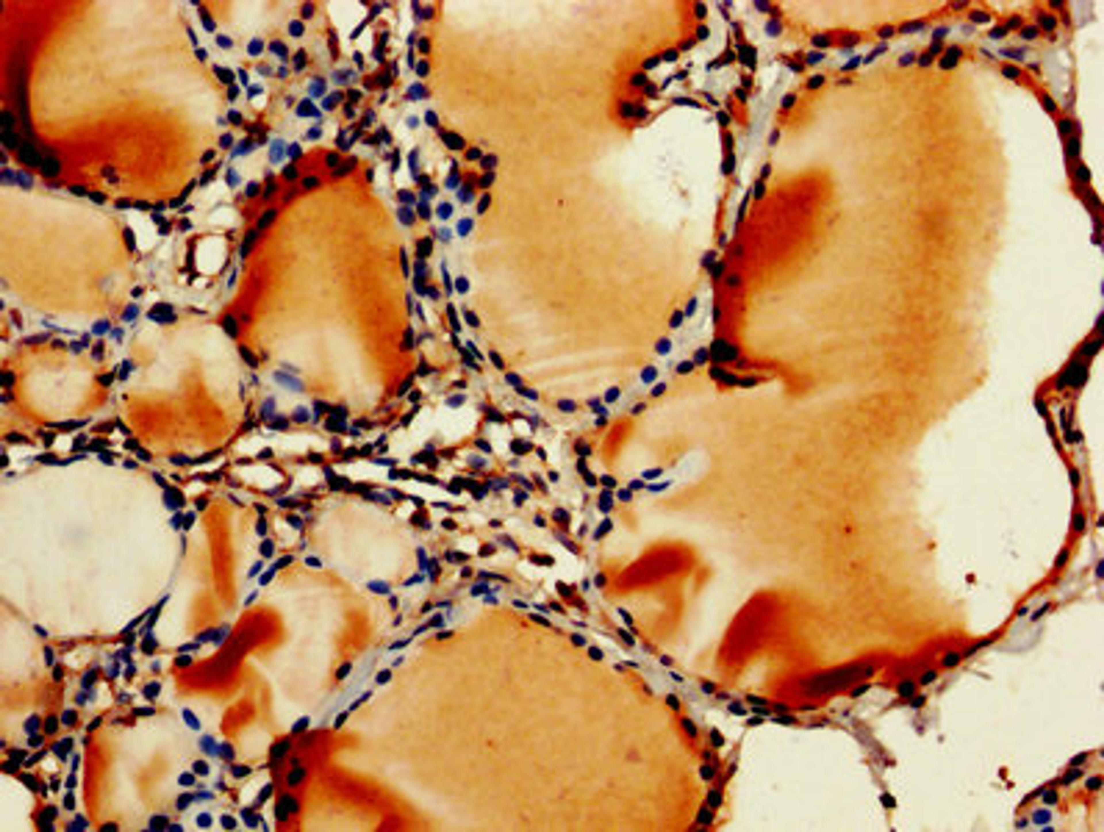 IHC image of CSB-PA00065A0Rb diluted at 1:250 and staining in paraffin-embedded human thyroid tissue performed on a Leica BondTM system. After dewaxing and hydration, antigen retrieval was mediated by high pressure in a citrate buffer (pH 6.0). Section was blocked with 10% normal goat serum 30min at RT. Then primary antibody (1% BSA) was incubated at 4&deg;C overnight. The primary is detected by a biotinylated secondary antibody and visualized using an HRP conjugated SP system.