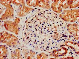 IHC image of CSB-PA859932LA01HU diluted at 1:800 and staining in paraffin-embedded human kidney tissue performed on a Leica BondTM system. After dewaxing and hydration, antigen retrieval was mediated by high pressure in a citrate buffer (pH 6.0). Section was blocked with 10% normal goat serum 30min at RT. Then primary antibody (1% BSA) was incubated at 4&deg;C overnight. The primary is detected by a biotinylated secondary antibody and visualized using an HRP conjugated SP system.