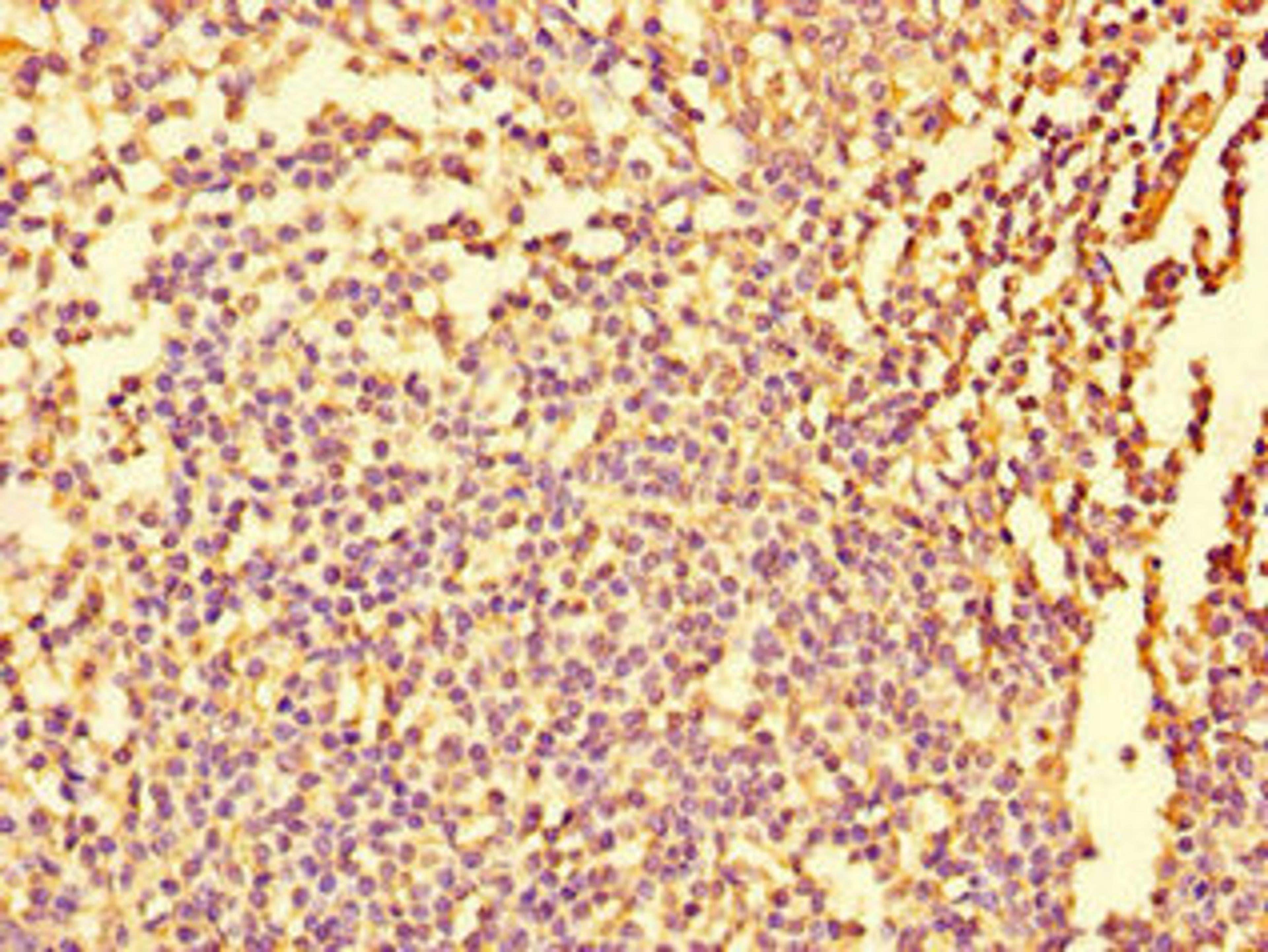 Immunohistochemistry of paraffin-embedded human tonsil tissue using CSB-PA008676LA01HU at dilution of 1:100