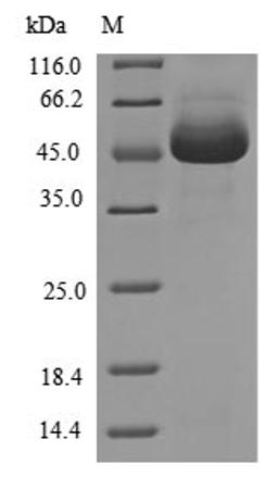 (Tris-Glycine gel) Discontinuous SDS-PAGE (reduced) with 5% enrichment gel and 15% separation gel.