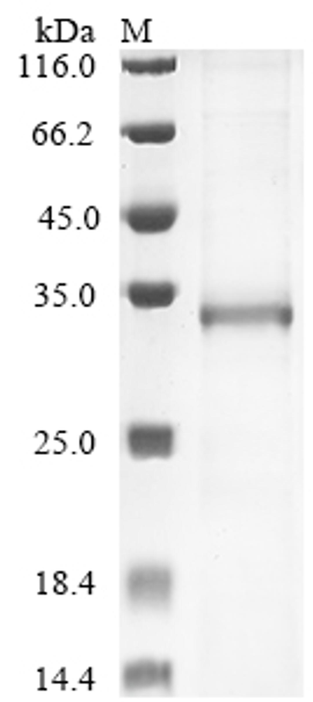 (Tris-Glycine gel) Discontinuous SDS-PAGE (reduced) with 5% enrichment gel and 15% separation gel.