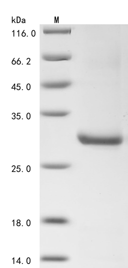 (Tris-Glycine gel) Discontinuous SDS-PAGE (reduced) with 5% enrichment gel and 15% separation gel.