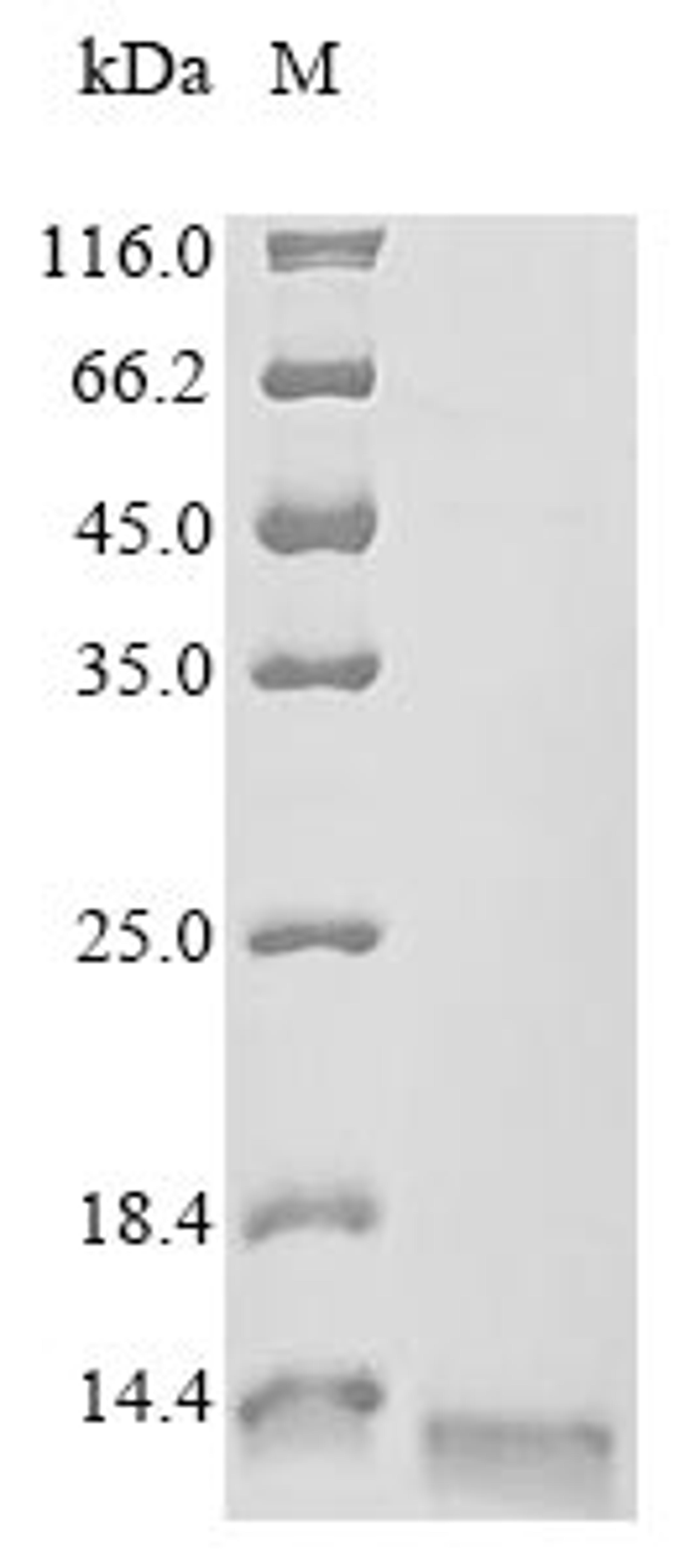 (Tris-Glycine gel) Discontinuous SDS-PAGE (reduced) with 5% enrichment gel and 15% separation gel.