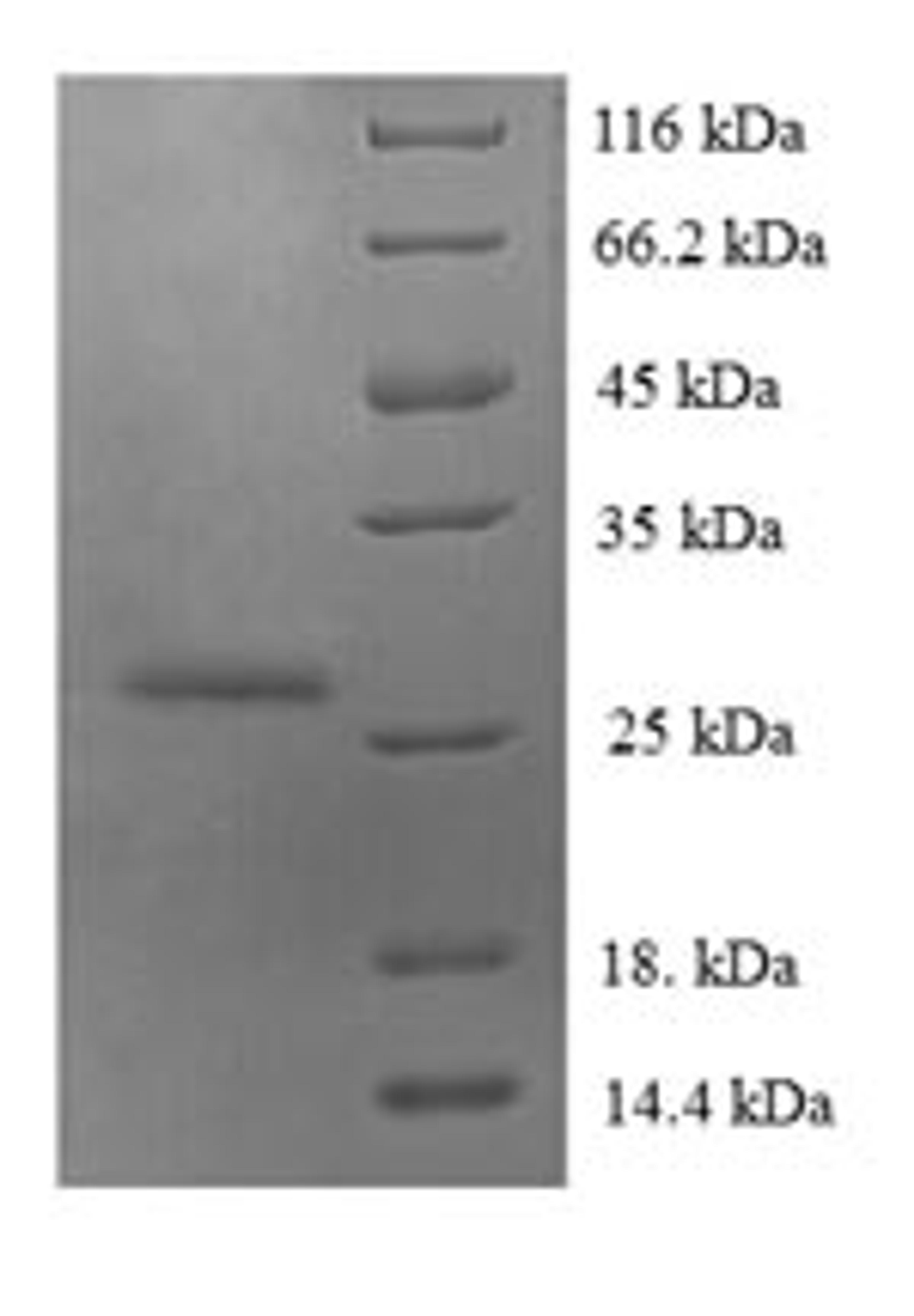 (Tris-Glycine gel) Discontinuous SDS-PAGE (reduced) with 5% enrichment gel and 15% separation gel.
