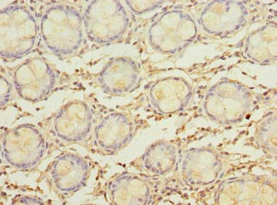 Immunohistochemistry of paraffin-embedded human colon tissue using CSB-PA015258LA01HU at dilution of 1:100