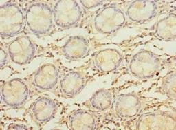 Immunohistochemistry of paraffin-embedded human colon tissue using CSB-PA015258LA01HU at dilution of 1:100