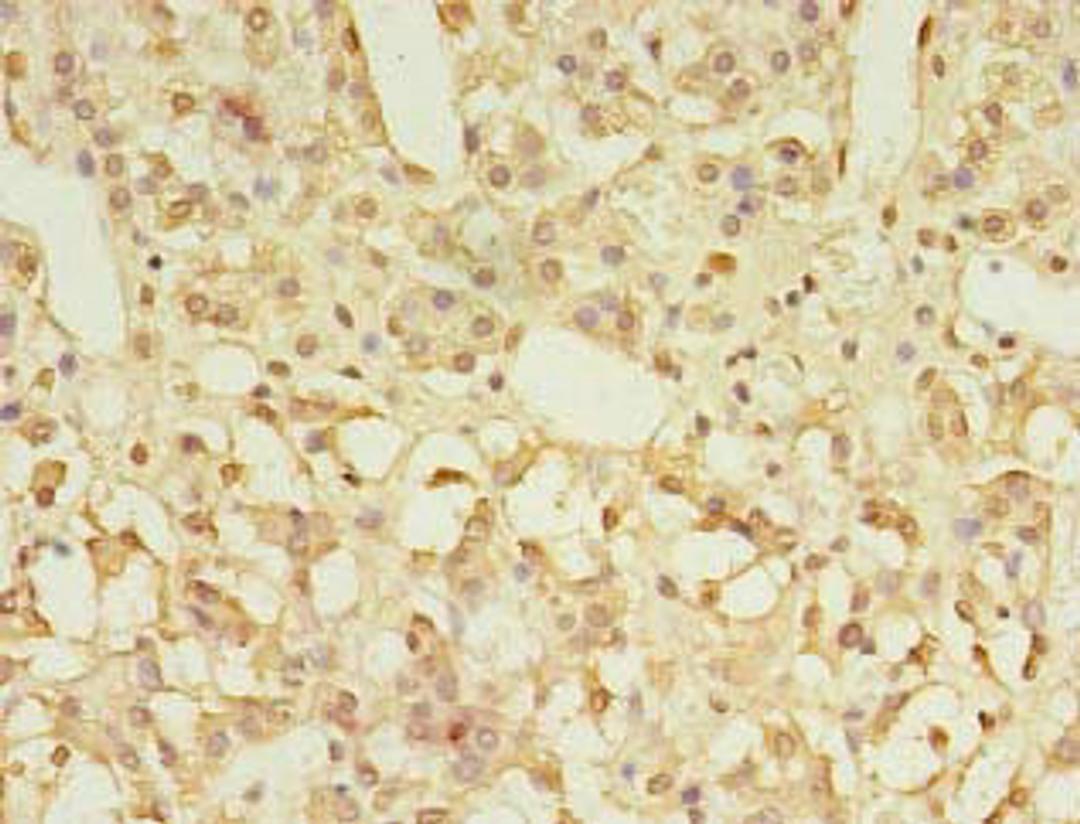 Immunohistochemistry of paraffin-embedded human adrenal gland tissue using CSB-PA009800LA01HU at dilution of 1:100
