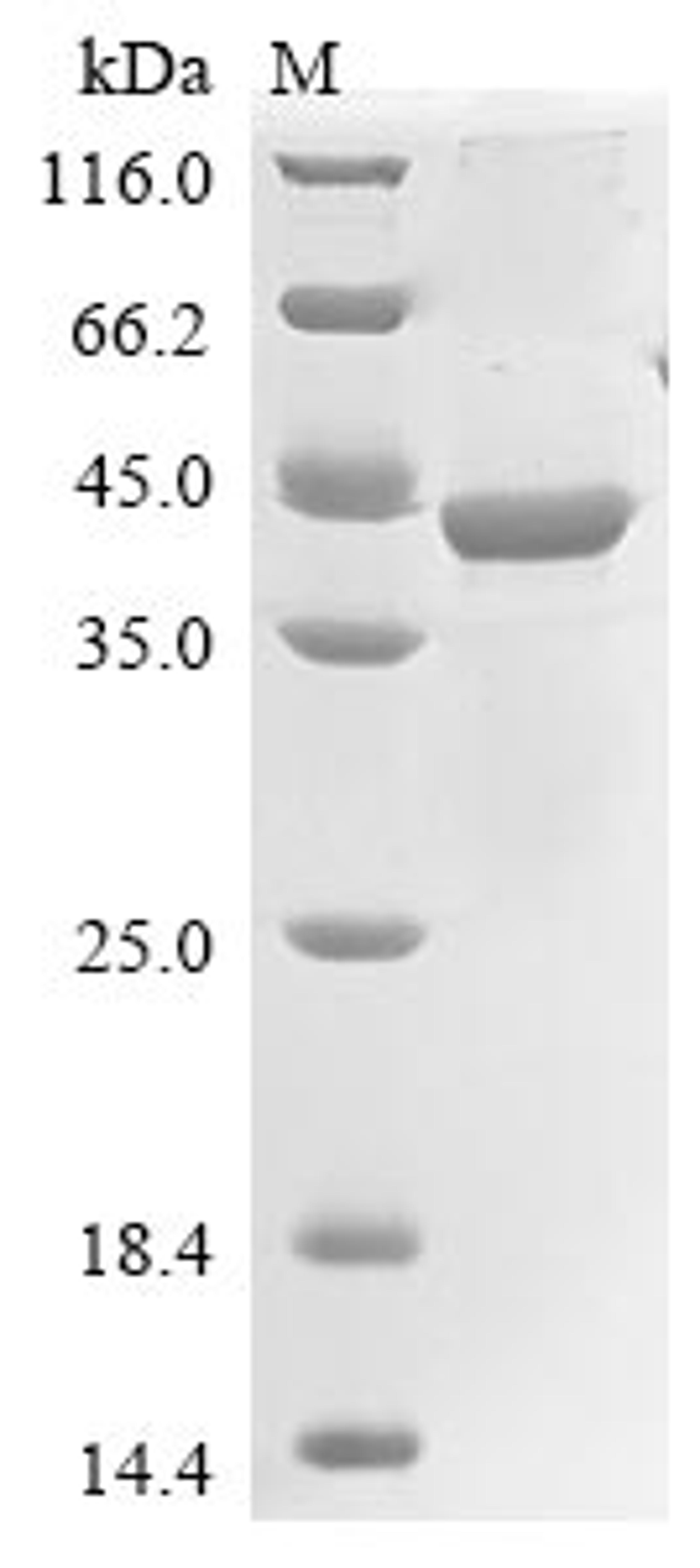 (Tris-Glycine gel) Discontinuous SDS-PAGE (reduced) with 5% enrichment gel and 15% separation gel.