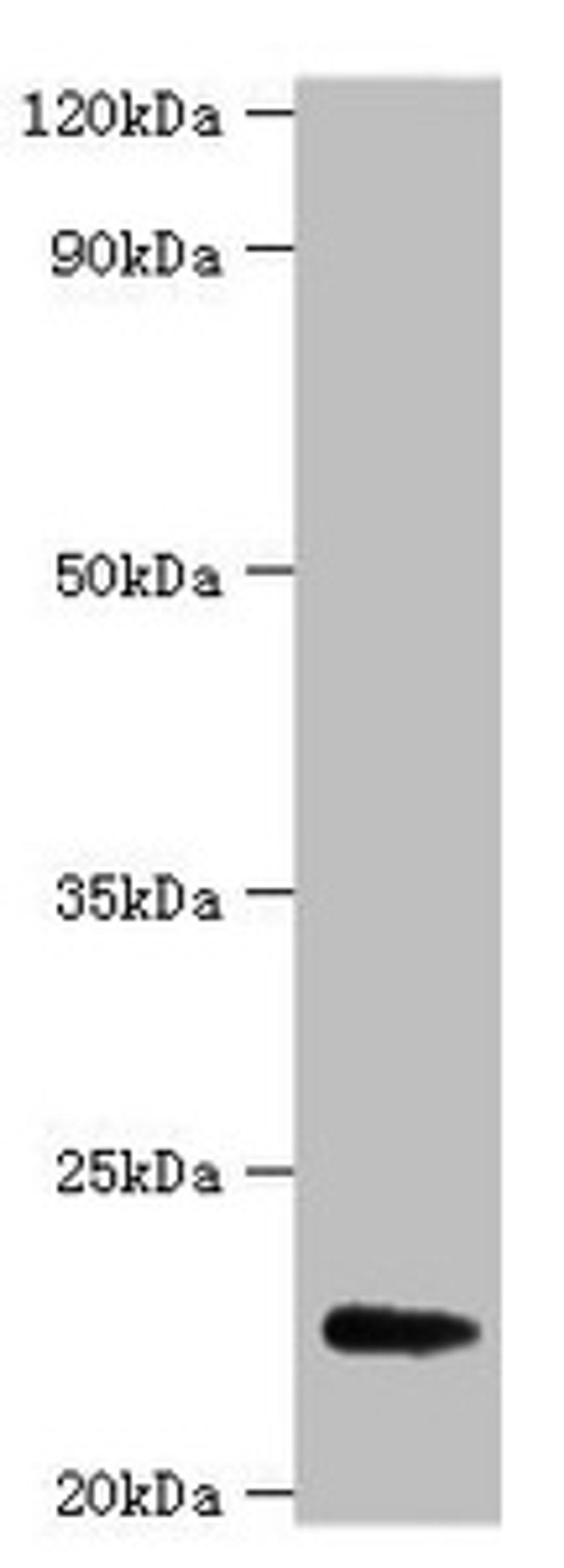 Western blot. All lanes: FGF21 antibody at 2µg/ml + A549 whole cell lysate. Secondary. Goat polyclonal to rabbit IgG at 1/15000 dilution. Predicted band size: 23 kDa. Observed band size: 23 kDa