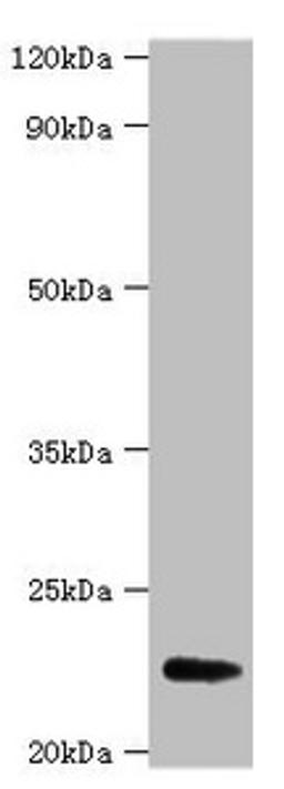 Western blot. All lanes: FGF21 antibody at 2µg/ml + A549 whole cell lysate. Secondary. Goat polyclonal to rabbit IgG at 1/15000 dilution. Predicted band size: 23 kDa. Observed band size: 23 kDa