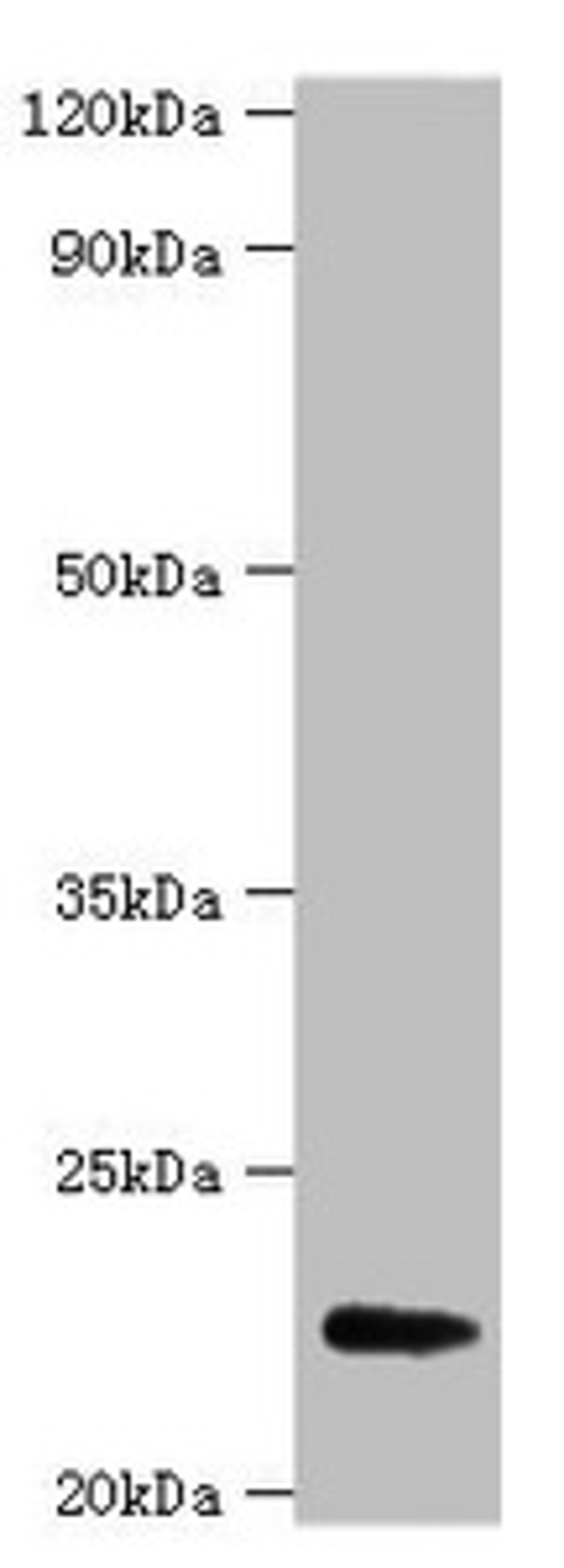 Western blot. All lanes: FGF21 antibody at 2µg/ml + A549 whole cell lysate. Secondary. Goat polyclonal to rabbit IgG at 1/15000 dilution. Predicted band size: 23 kDa. Observed band size: 23 kDa