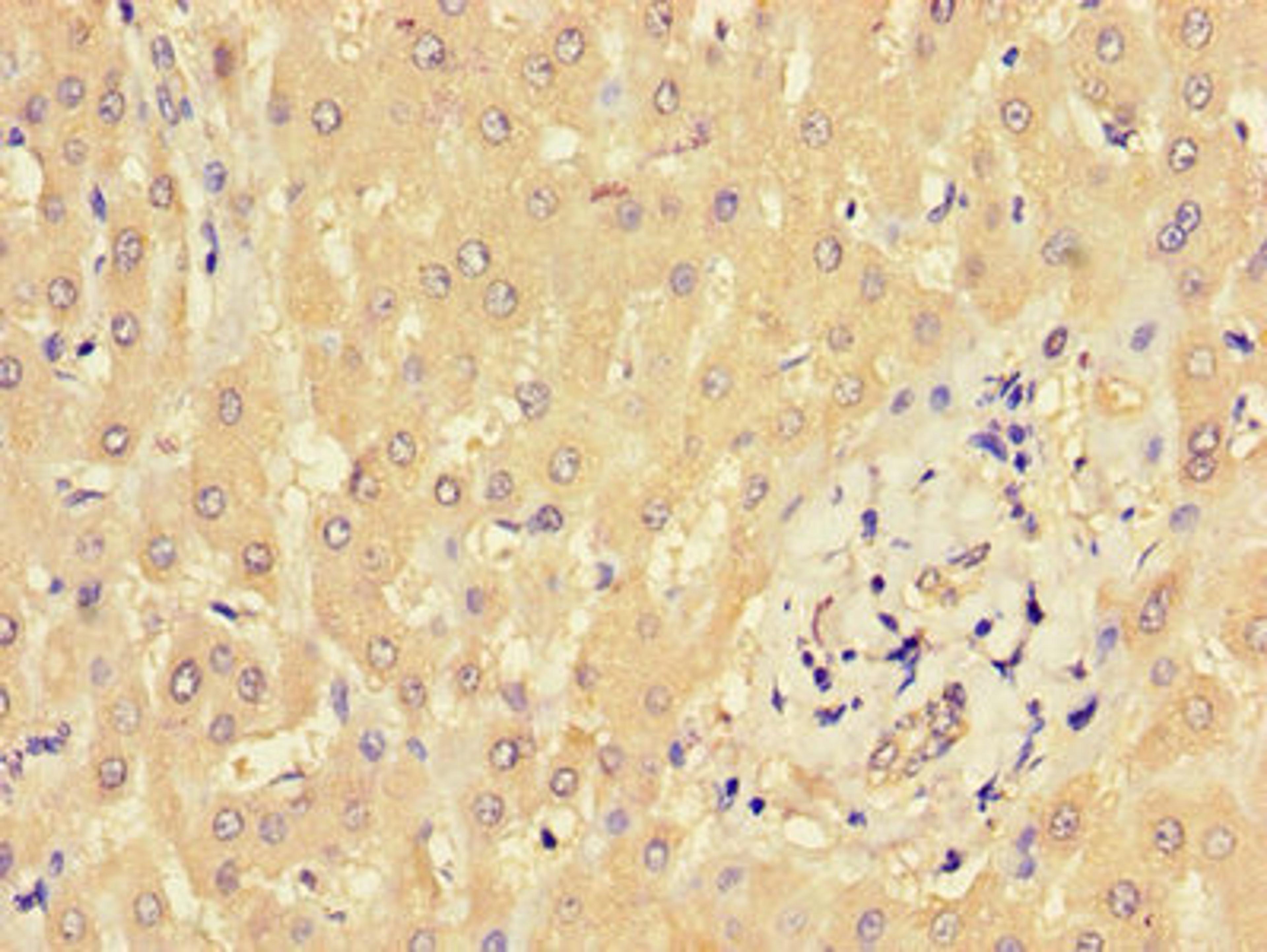 Immunohistochemistry of paraffin-embedded human liver tissue using CSB-PA659641LA01HU at dilution of 1:100