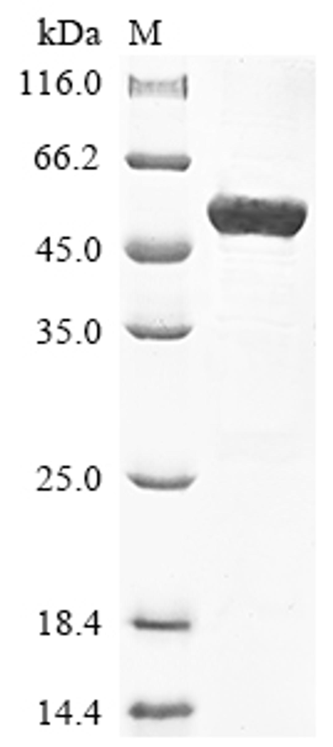 (Tris-Glycine gel) Discontinuous SDS-PAGE (reduced) with 5% enrichment gel and 15% separation gel.