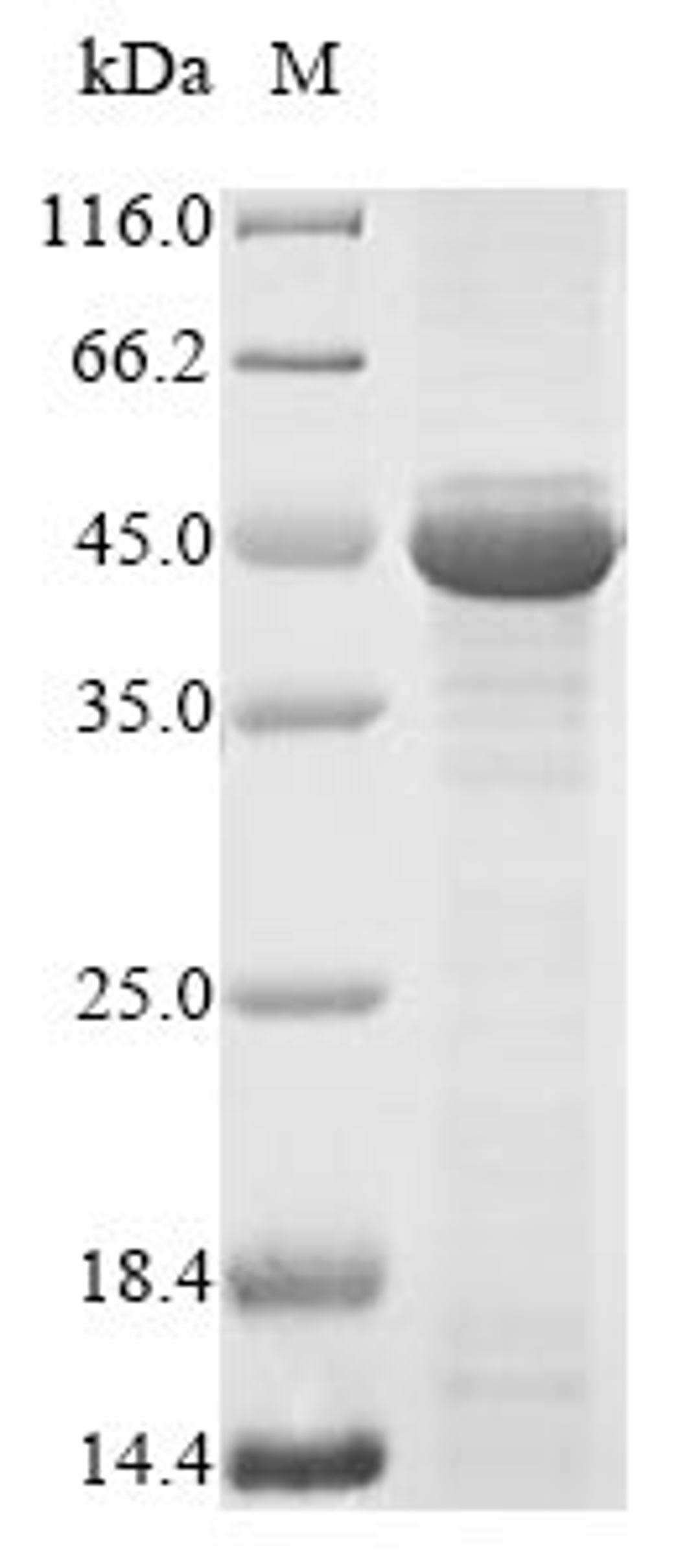 (Tris-Glycine gel) Discontinuous SDS-PAGE (reduced) with 5% enrichment gel and 15% separation gel.