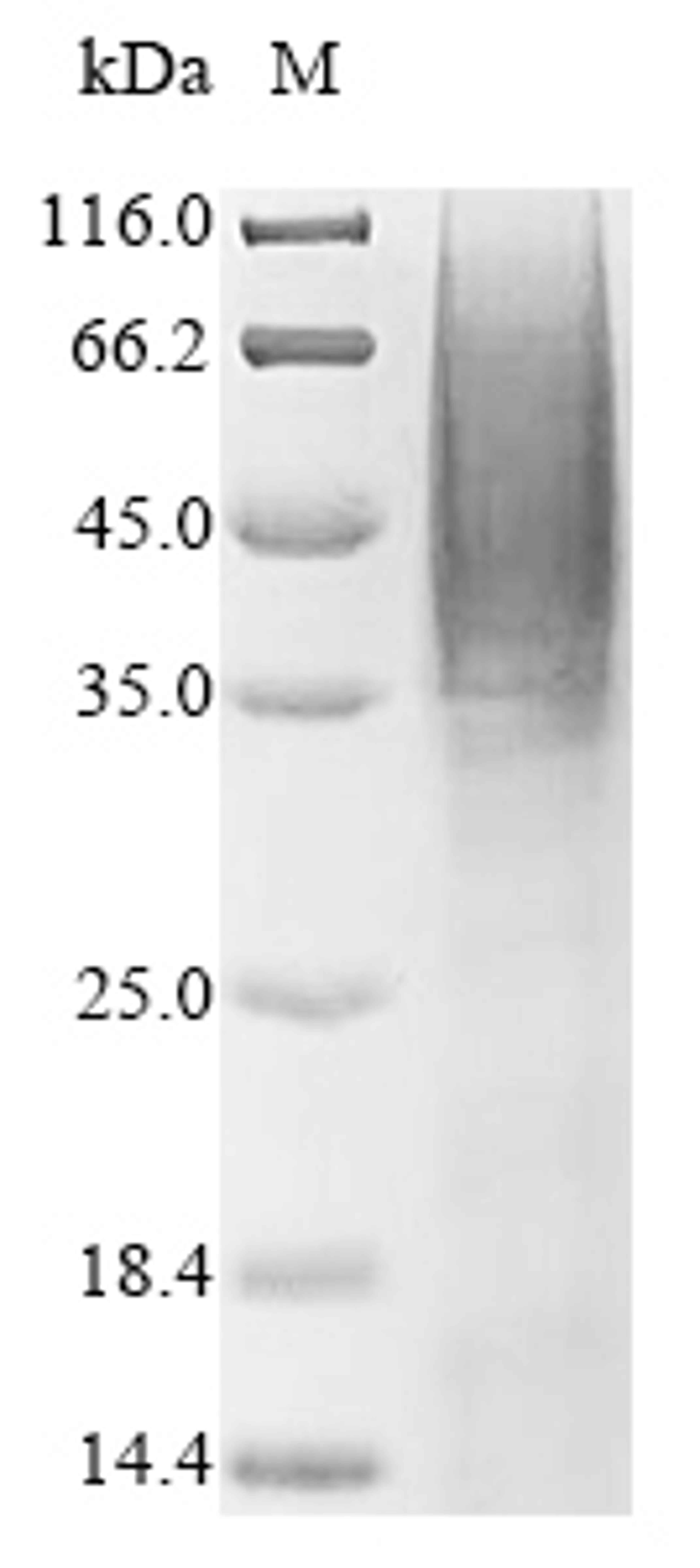 (Tris-Glycine gel) Discontinuous SDS-PAGE (reduced) with 5% enrichment gel and 15% separation gel.