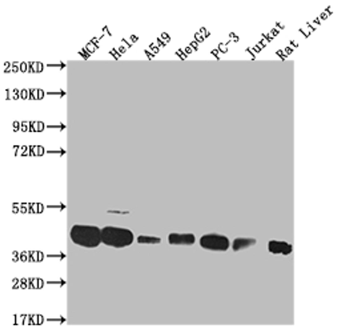 Western Blot. Positive WB detected in: MCF-7 whole cell lysate, Hela whole cell lysate, A549 whole cell lysate, HepG2 whole cell lysate, PC-3 whole cell lysate, Jurkat whole cell lysate, Rat liver tissue. All lanes: MAS1L antibody at 1:1000. Secondary. Goat polyclonal to rabbit IgG at 1/50000 dilution. Predicted band size: 43 kDa. Observed band size: 36-50 kDa. 