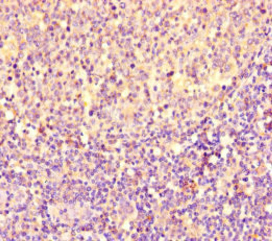 Immunohistochemistry of paraffin-embedded human tonsil tissue using CSB-PA017873LA01HU at dilution of 1:100