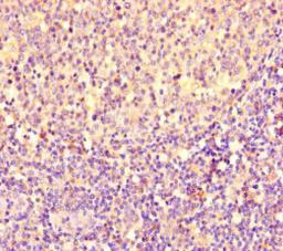 Immunohistochemistry of paraffin-embedded human tonsil tissue using CSB-PA017873LA01HU at dilution of 1:100