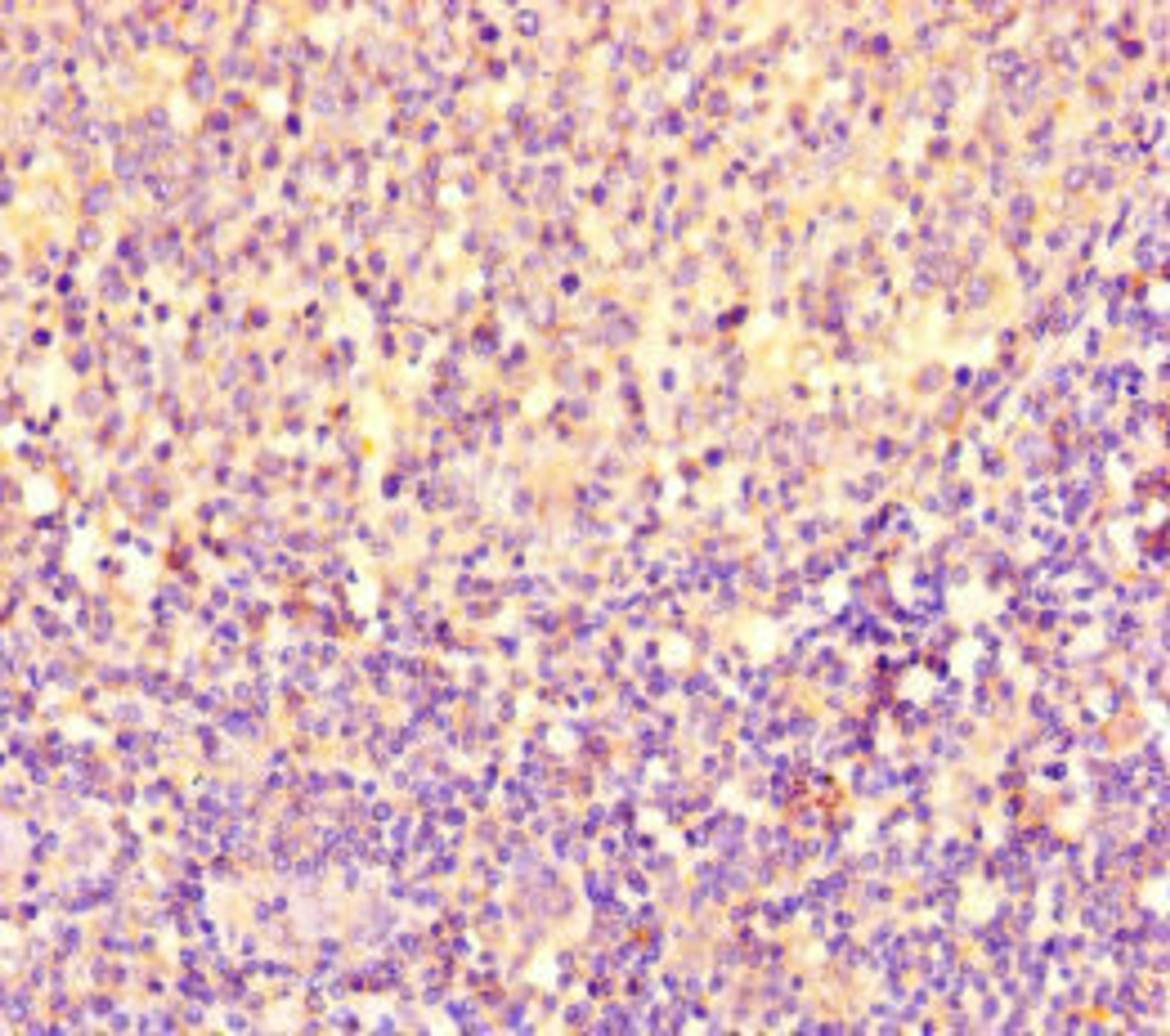 Immunohistochemistry of paraffin-embedded human tonsil tissue using CSB-PA017873LA01HU at dilution of 1:100