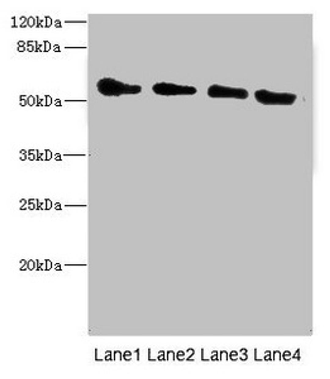 Western blot. All lanes: TRHDE antibody at 1.77ug/ml. Lane 1: Rat heart tissue. Lane 2: Mouse kidney tissue. Lane 3: 293T whole cell lysate. Lane 4: HepG2 whole cell lysate. Secondary. Goat polyclonal to rabbit IgG at 1/10000 dilution. Predicted band size: 117 kDa. Observed band size: 117 kDa. 