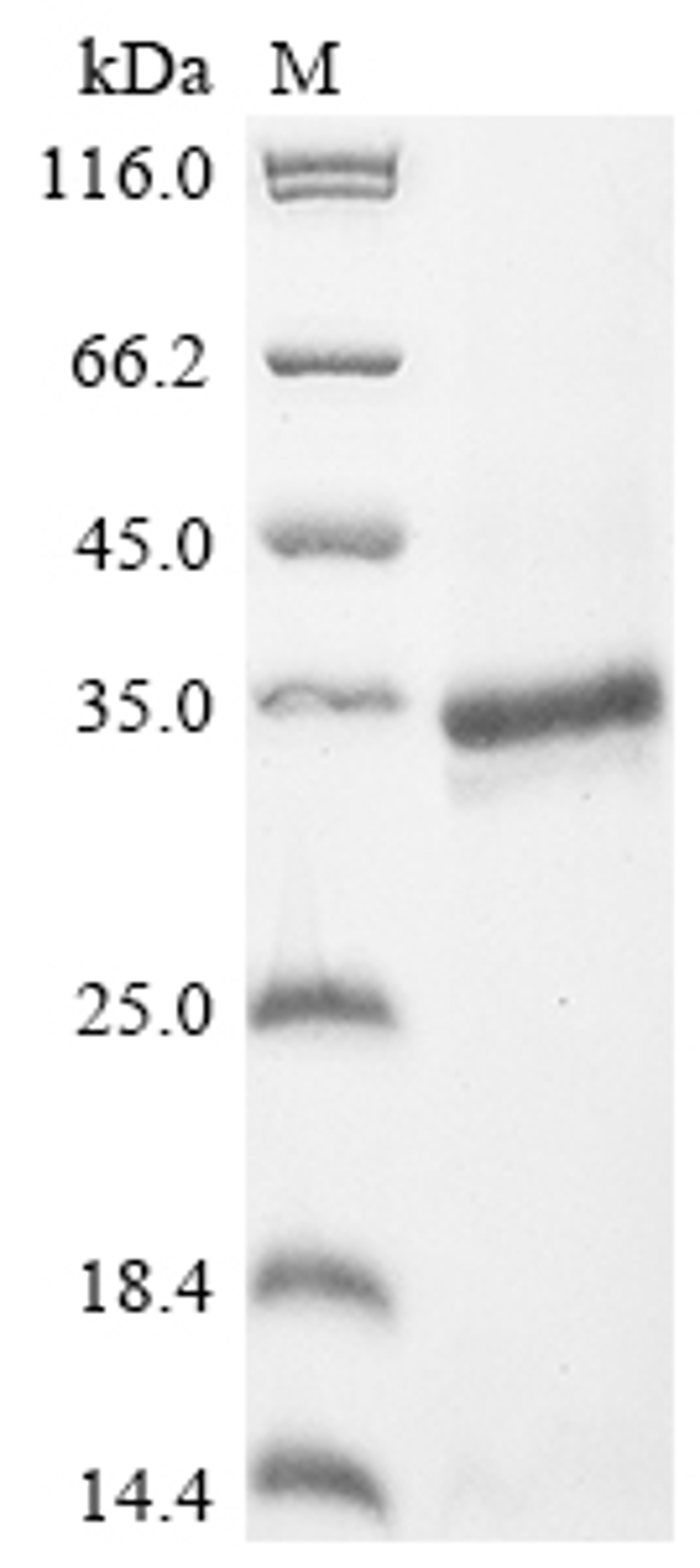 (Tris-Glycine gel) Discontinuous SDS-PAGE (reduced) with 5% enrichment gel and 15% separation gel.