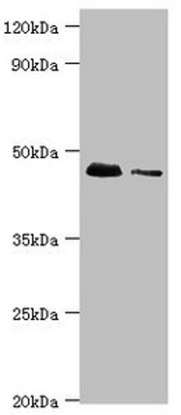 Western blot. All lanes: 28S ribosomal protein S29, mitochondrial antibody at 10ug/ml. Lane 1: Hela whole cell lysate. Lane 2: 293T whole cell lysate. Secondary. Goat polyclonal to rabbit IgG at 1/10000 dilution. Predicted band size: 46, 42 kDa. Observed band size: 46 kDa. 
