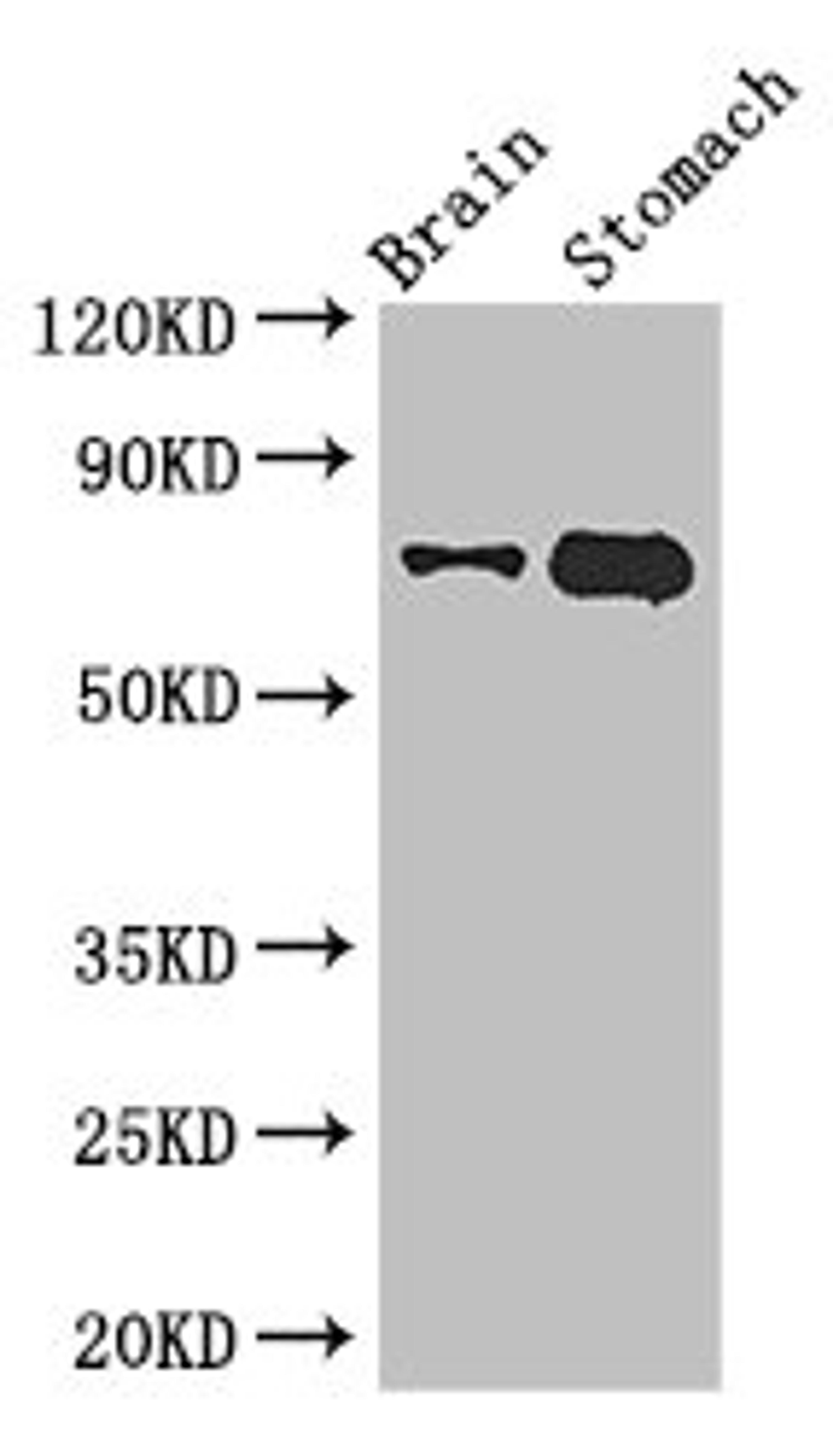 Western Blot. Positive WB detected in: Mouse brain tissue, Mouse stomach tissue. All lanes: EXD2 antibody at 2.8ug/ml. Secondary. Goat polyclonal to rabbit IgG at 1/50000 dilution. Predicted band size: 71, 57 kDa. Observed band size: 71 kDa.